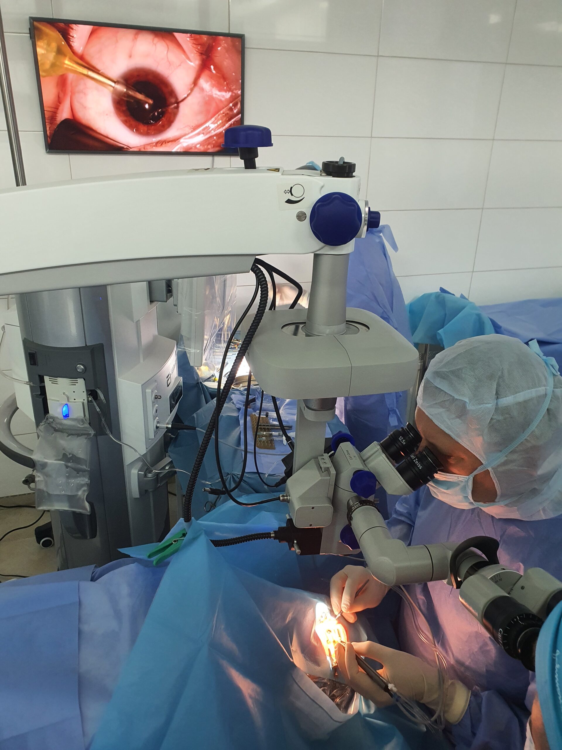 імплантація Pure See 4